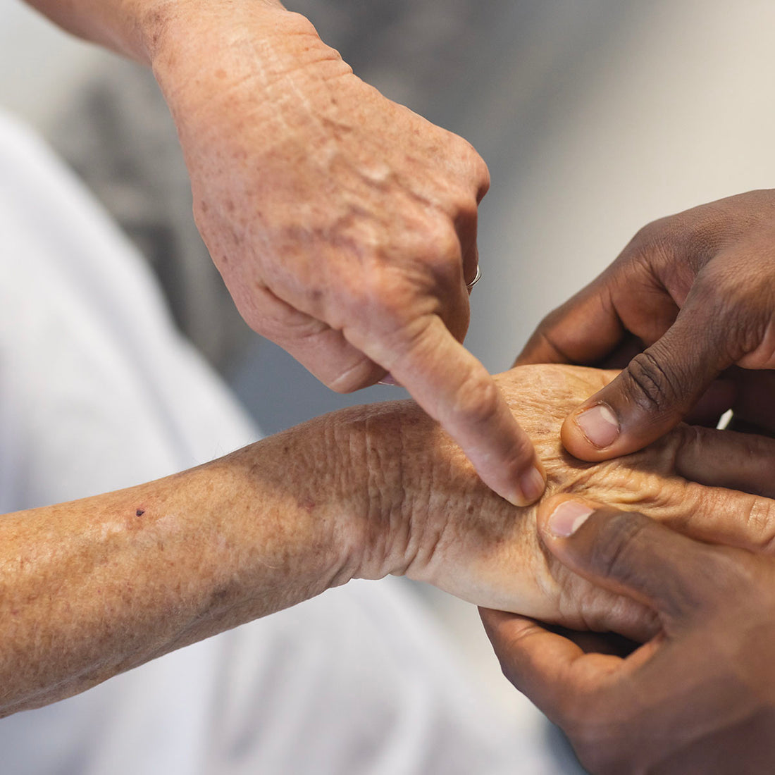 Parkinson Disease and Movement