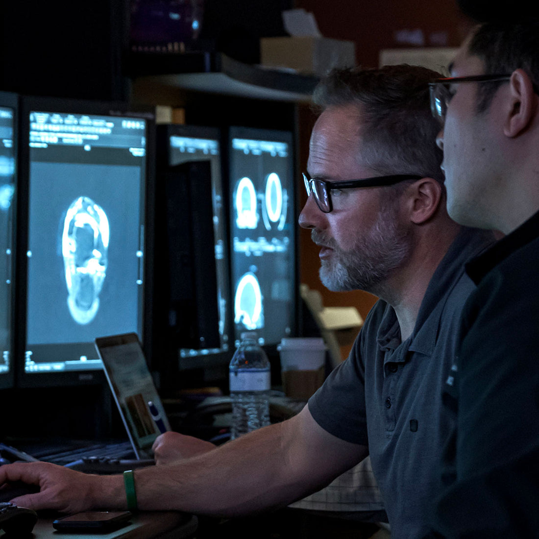 Musculoskeletal Research