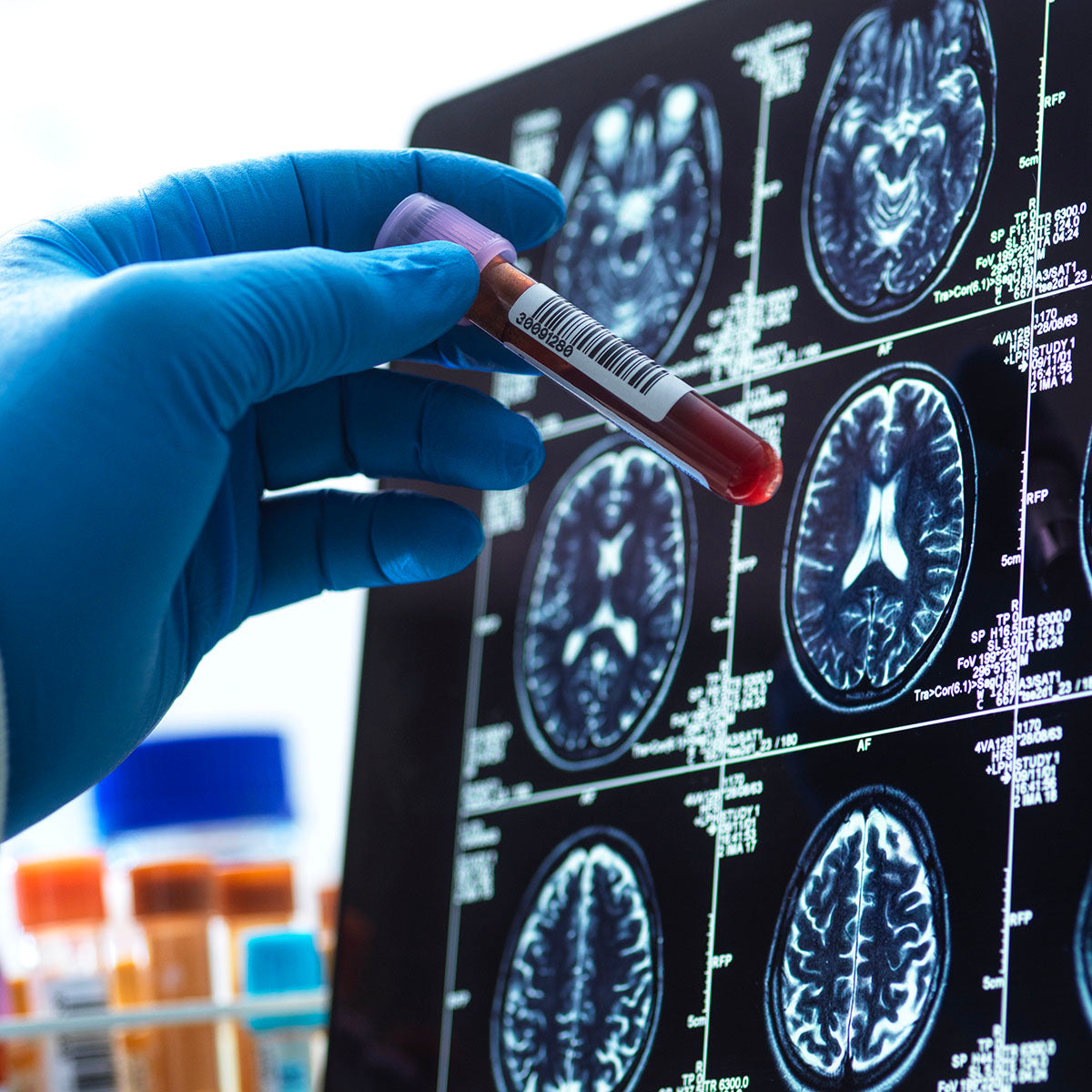 Emory Brain Health Center Directors Fund