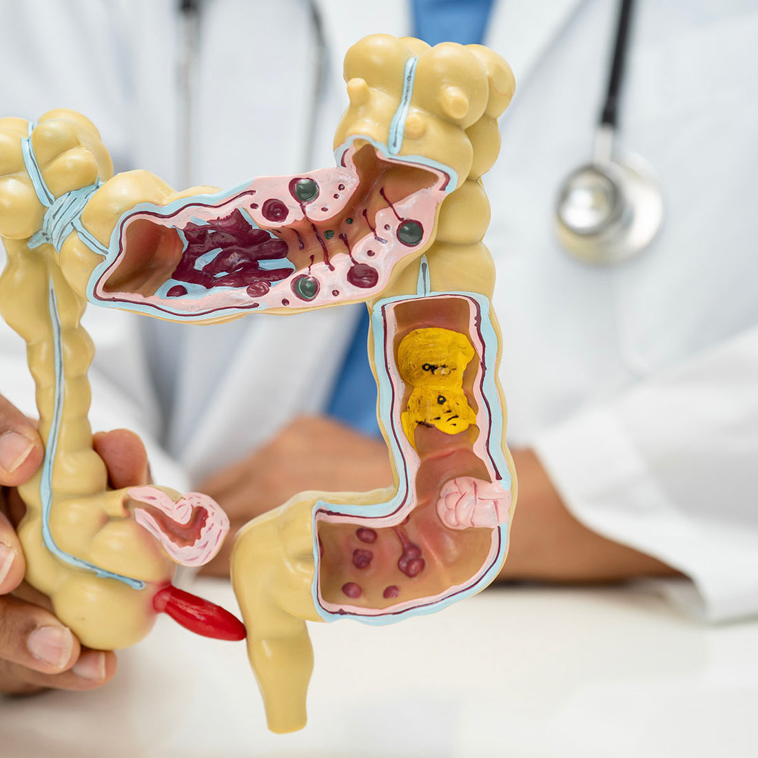 Crohns Disease Fund
