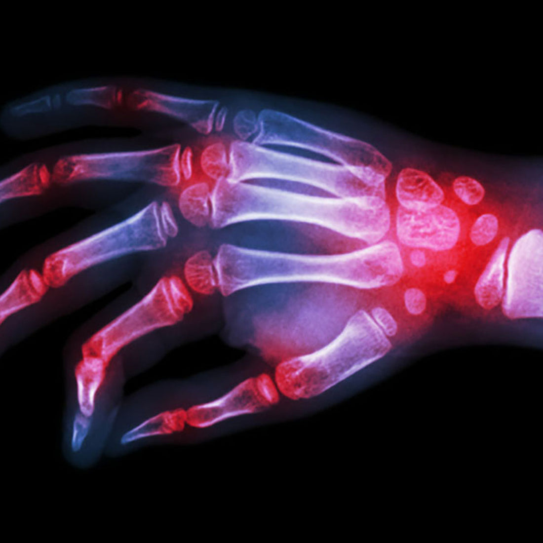 Lowance Center for Human Immunology