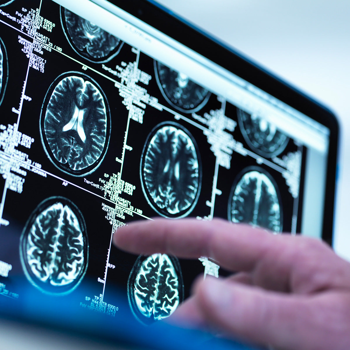 Center for Neurodegenerative Disease