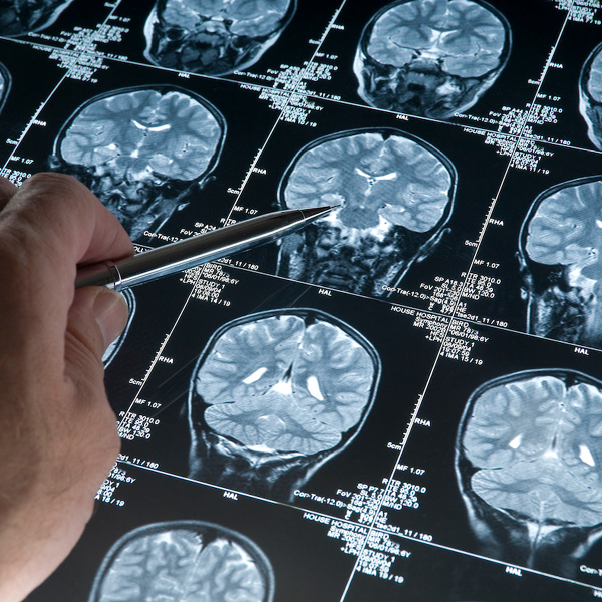 Emory Brain Restoration Center Fund